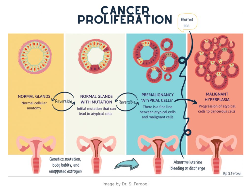 Fertility Preservation in Endometrial Cancer